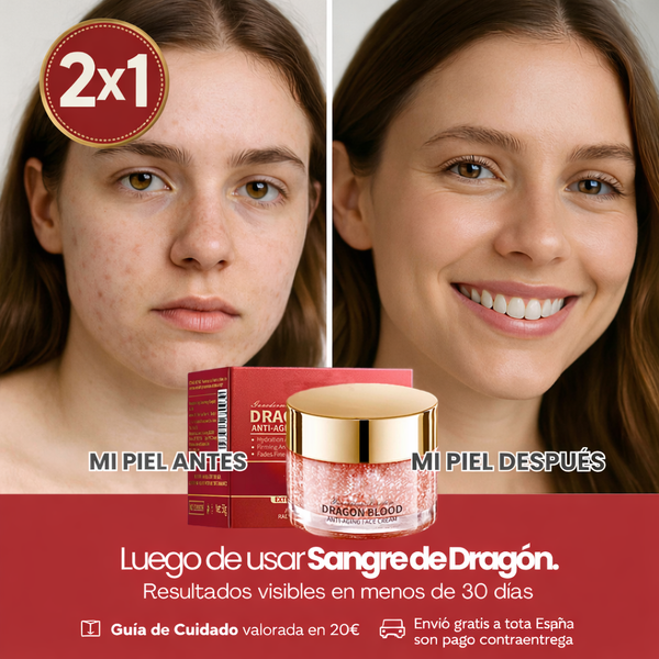 Crema Facial Reparadora Dragon Blood – Nutrición Intensiva de Invierno